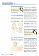 Injection Techniques2.webp