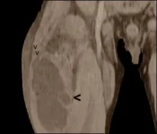 uploadfromtaptalk1435617541488.webp uploadfromtaptalk1435617541488.webp