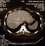 uploadfromtaptalk1435715532687.gif uploadfromtaptalk1435715532687.gif