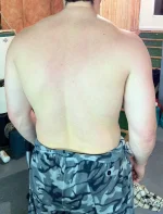 4 weeks-rear lat.webp