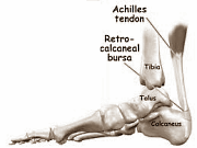 calcaneustendon.gif calcaneustendon.gif