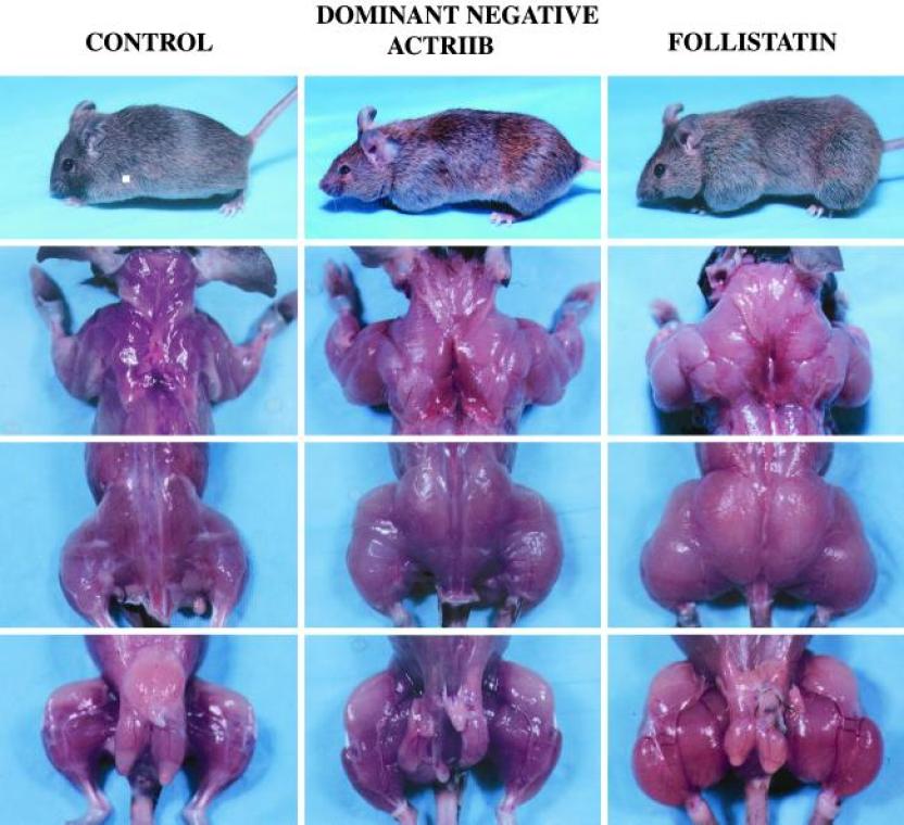 Flex Wheeler Myostatin Deficiency | Genetics Study Conducted On Mr. Olympia Bodybuilders