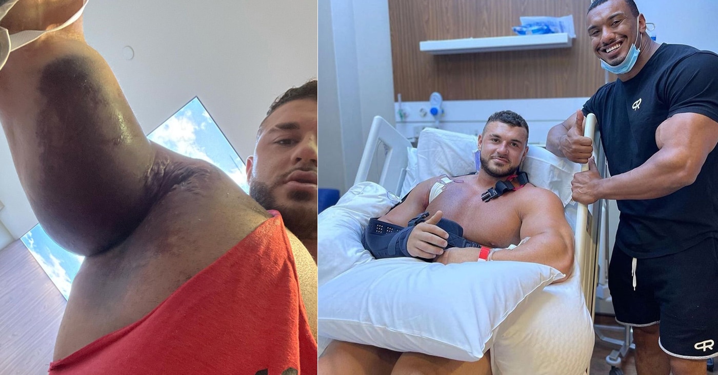 Bodybuilder Ryan Crowley Has Successful Surgery Following Devastating Pec Injury