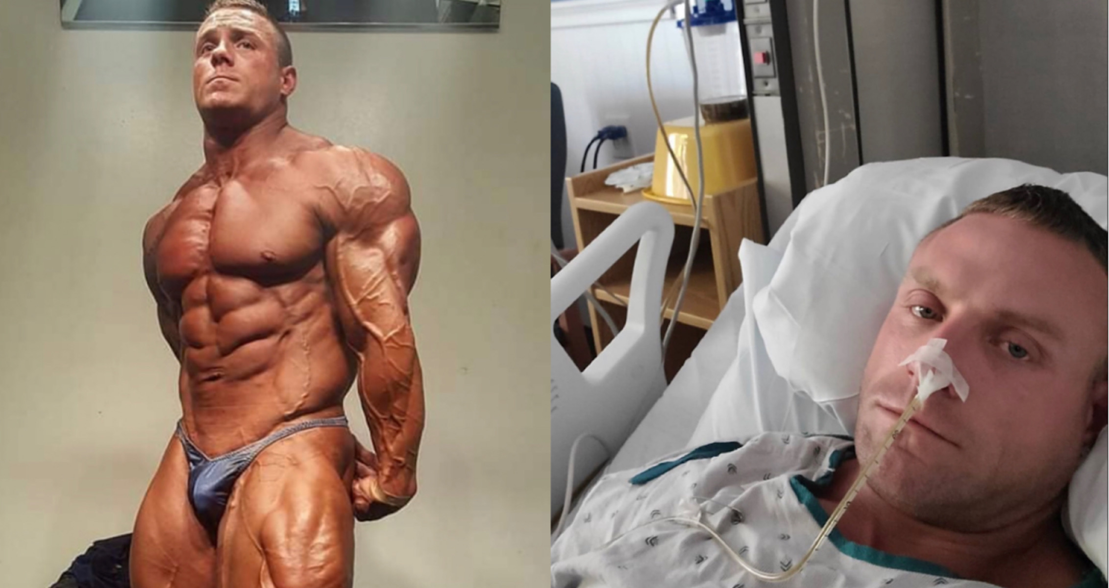 Brad Rowe Hospitalized With Intestinal Obstruction