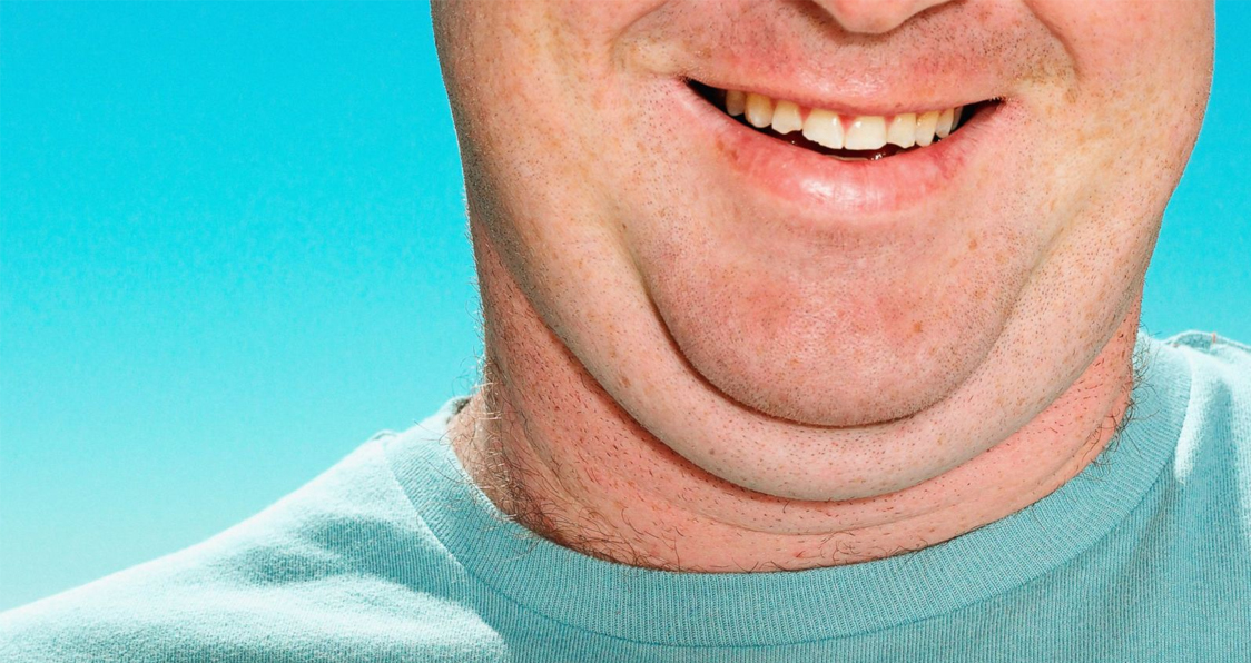 Get Rid of Your Double Chin – Fast!
