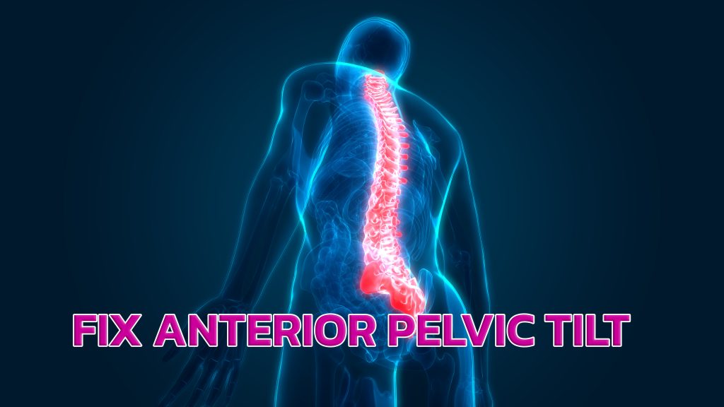 Anterior Pelvic Tilt Fix for Bodybuilders