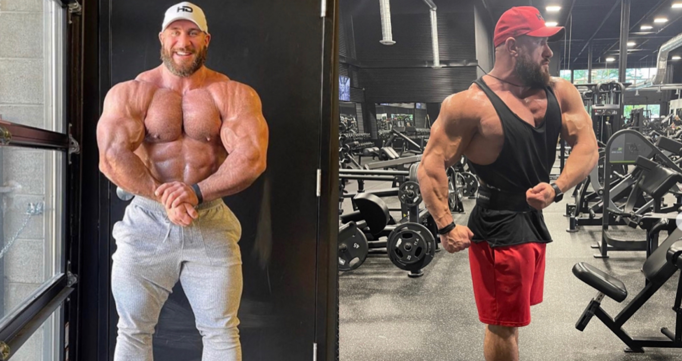 Antoine Vaillant Appears Downsized After Bicep Injury