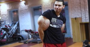 Russian ‘Popeye’ Kirill Tereshin Risks Death If Jelly Is Not Removed From Biceps