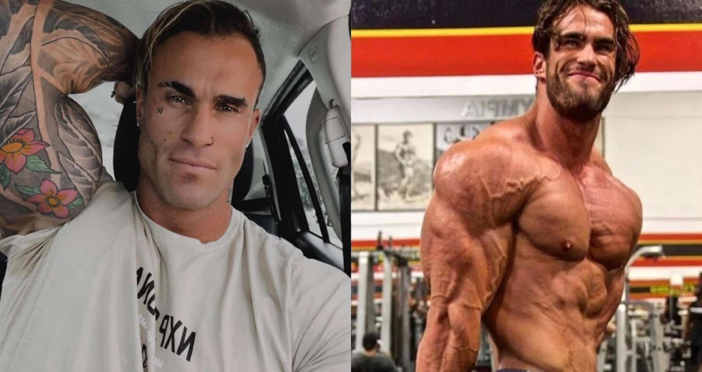 Calum Von Moger Received Spinal Surgery Following Fall From Second Story Window, Currently In Stable Condition