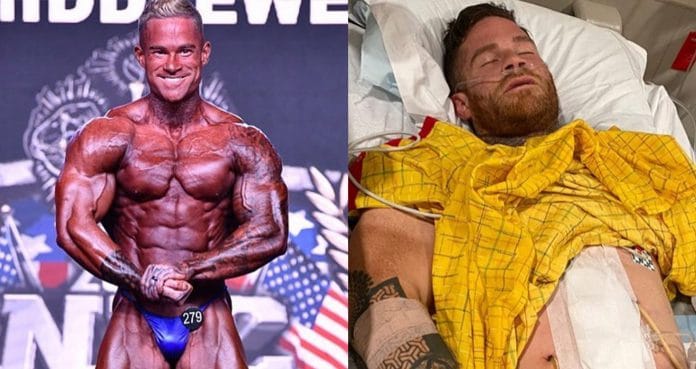 IFBB Pro Bodybuilder Shane Post Shot During Argument Over A Parkin Space