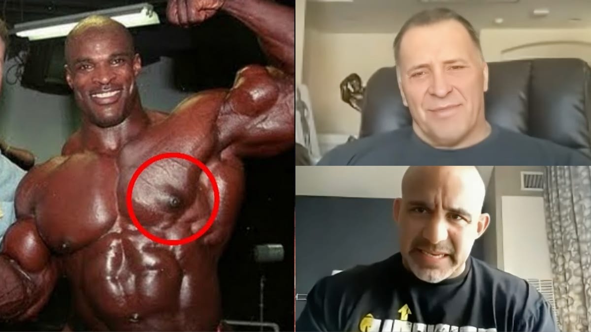 Insane Stories of Gyno Surgery Gone Wrong by Milos Sarcev