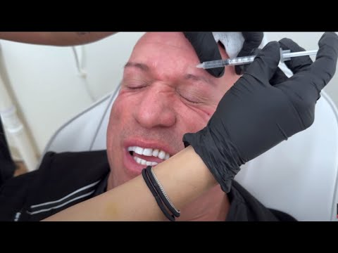 EXPERIMENTING WITH NEW ANTI-AGING PEPTIDE!