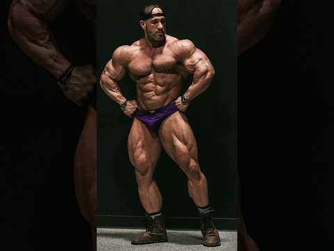 Antoine looking ridiculous