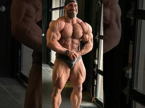 Insane shoulder striations
