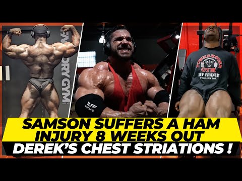 Samson Dauda suffers a Hamstring injury 8 weeks out + Can Derek have cross striated chest ? +Carlos