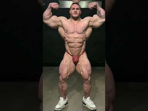 Nick Walker’s insane conditioning 2 months after injury