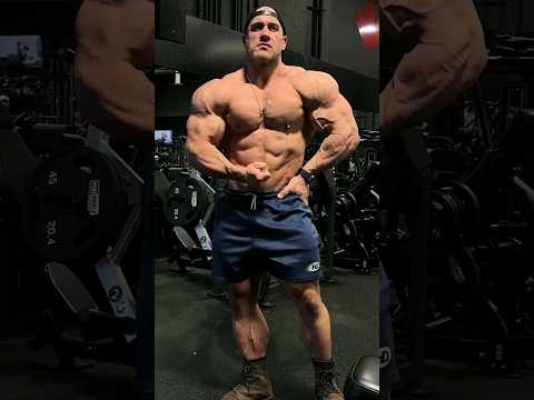 Antoine’s upper half looking much improved