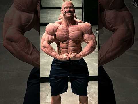 William Martin’s amazing transformation,  Looks really peeled compared to last year