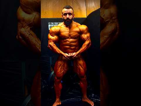 Hadi Choopan’s waist has improved so much in last 3 months